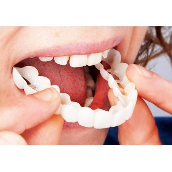 Simulation Whitening Lower Row Braces Teeth Whitening Kit Upper Row Dentures Braces