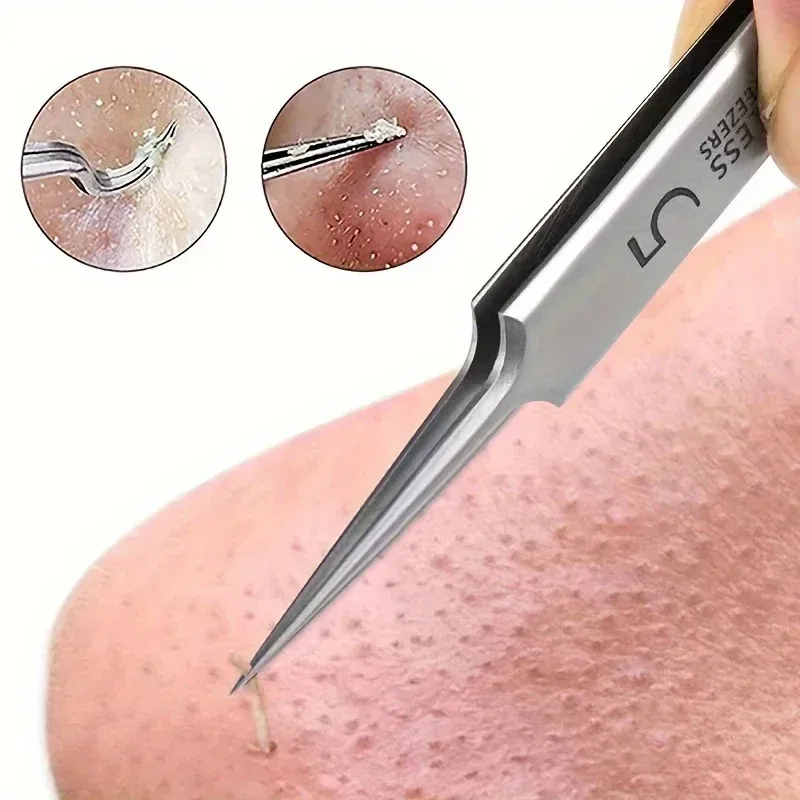 Cell acne blackhead tweezers remove acne needle tool facial beauty skin care