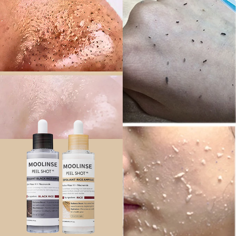 Korean White And Black Rice Exfoliating Serum Facial Moisturizing Soften Blackhead Removal Hydrating Pore Shrinking Skin Care